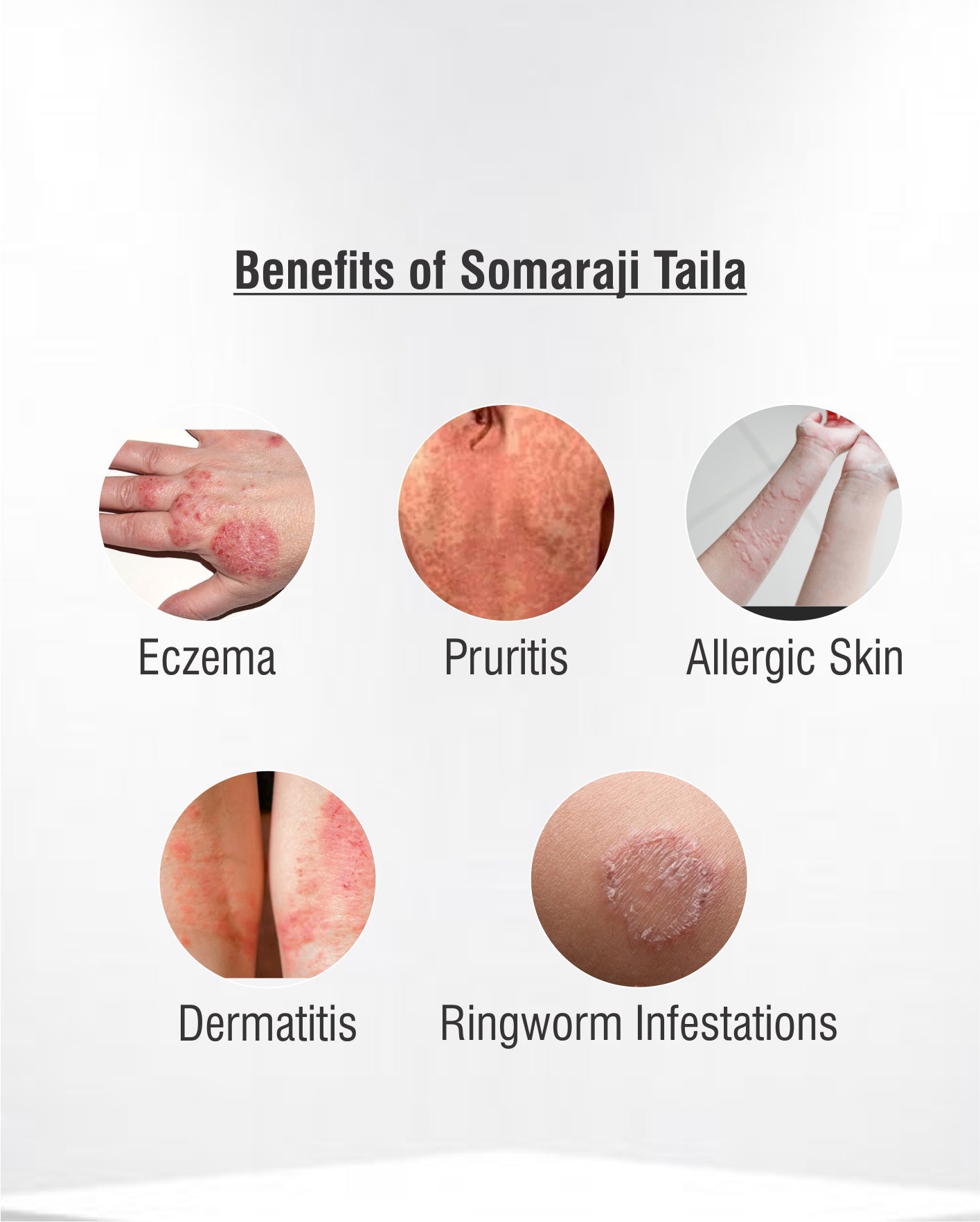 Somaraji Taila 100 ml