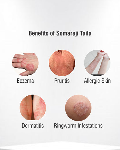 Somaraji Taila 100 ml